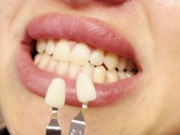 Botox Cheltenham, Spray tans Cheltenham, Microneedling Cheltenham, Chemical peel Cheltenham , Anti-wrinkle injections Cheltenham, Skin clinic Cheltenham dermal fillers cheltenham