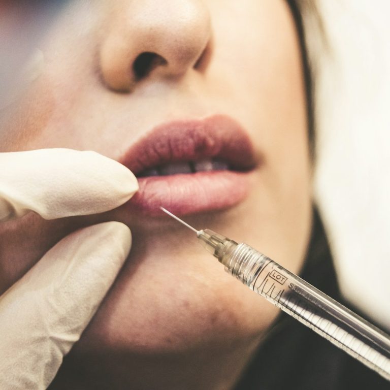 Vitamin B12 Injections cheltenham Lip fillers in Cheltenham, microneedling in cheltenham, Dermal lip fillers cotswolds